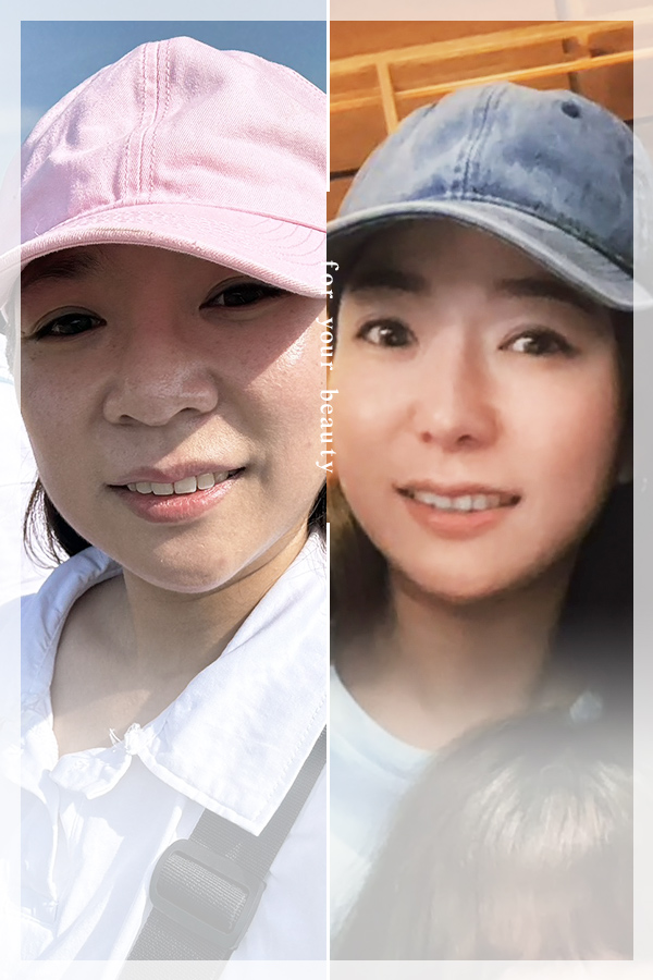 美麗見證公版-0715-陵_隆鼻